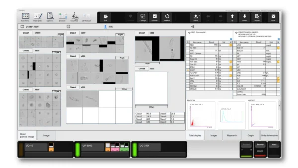 Autoanalizador de imágenes digitales en orina modelo UD-10 de Sysmex - Imagen 3