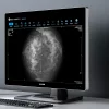 Monitor de diagnóstico marca JUSHA, modelo C1210G - Imagen 2