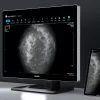 Monitor de diagnóstico marca JUSHA, modelo CP620 - Imagen 4