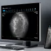 Monitor de diagnóstico marca JUSHA, modelo CP620 - Imagen 5