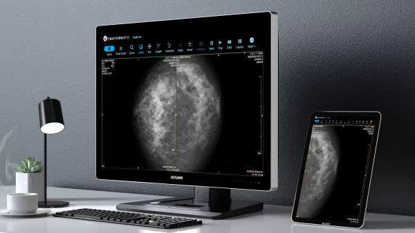 Monitor de diagnóstico marca JUSHA, modelo CP620 - Imagen 5