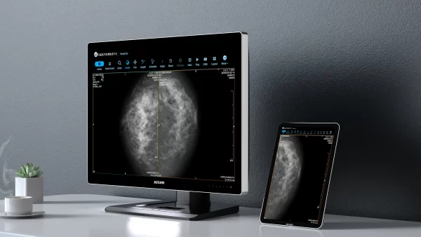 Monitor de diagnóstico marca JUSHA, modelo CP620 - Imagen 6