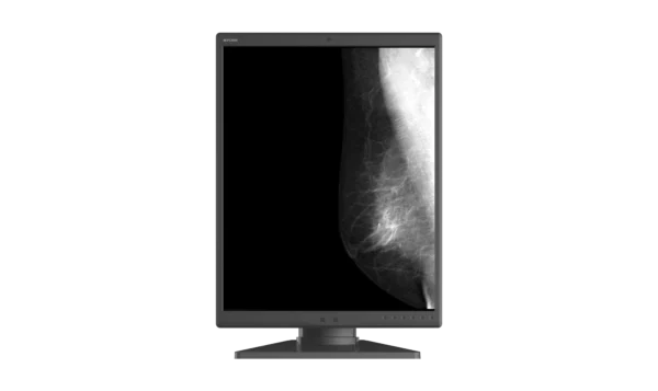 Monitor de diagnóstico marca JUSHA, modelo M550GQ - Imagen 3