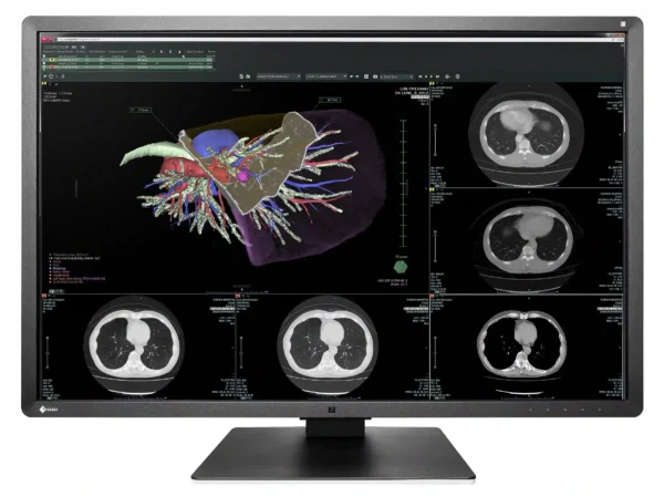 Monitor de diagnóstico marca EIZO, modelo RX660 - Imagen 3