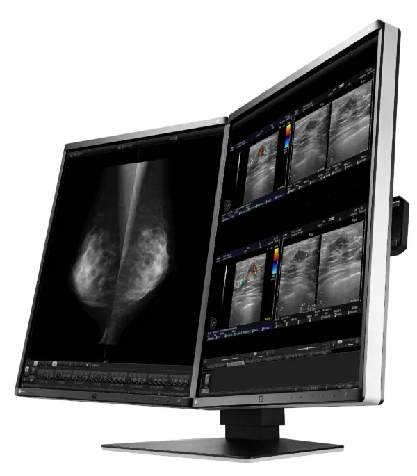 Monitor de diagnóstico marca EIZO, modelo RX560-MD