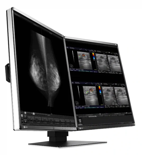 Monitor de diagnóstico marca EIZO, modelo RX560-MD - Imagen 3