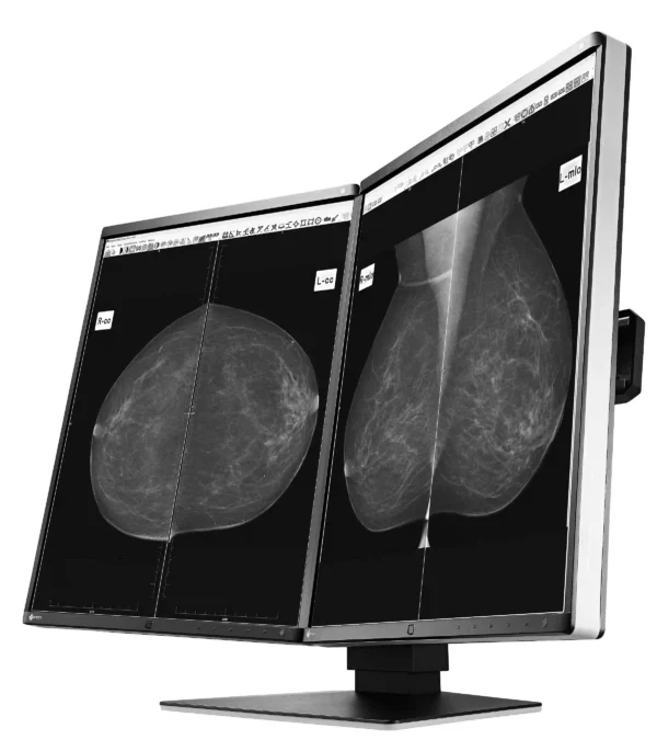 Monitor de diagnóstico marca EIZO, modelo GX560-MD