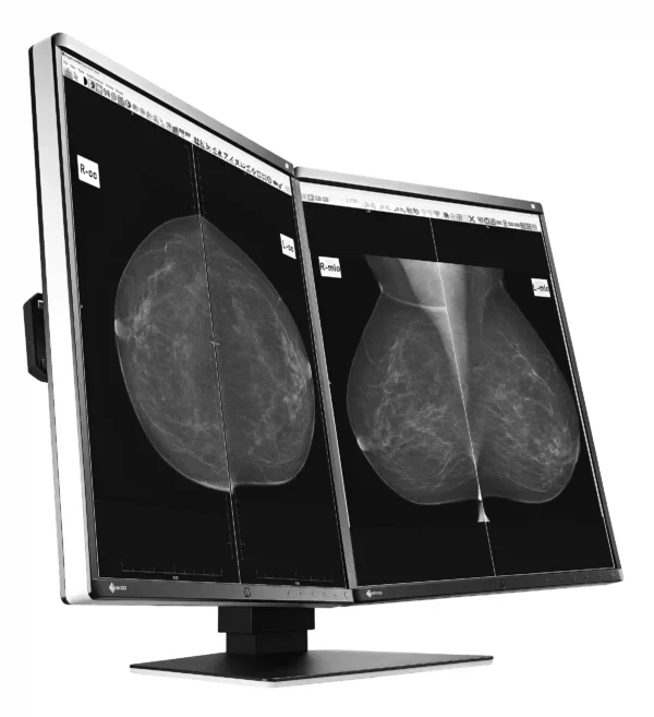 Monitor de diagnóstico marca EIZO, modelo GX560-MD - Imagen 3