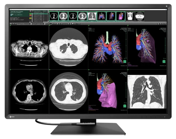 Monitor de diagnóstico marca EIZO, modelo RX1270 - Imagen 2